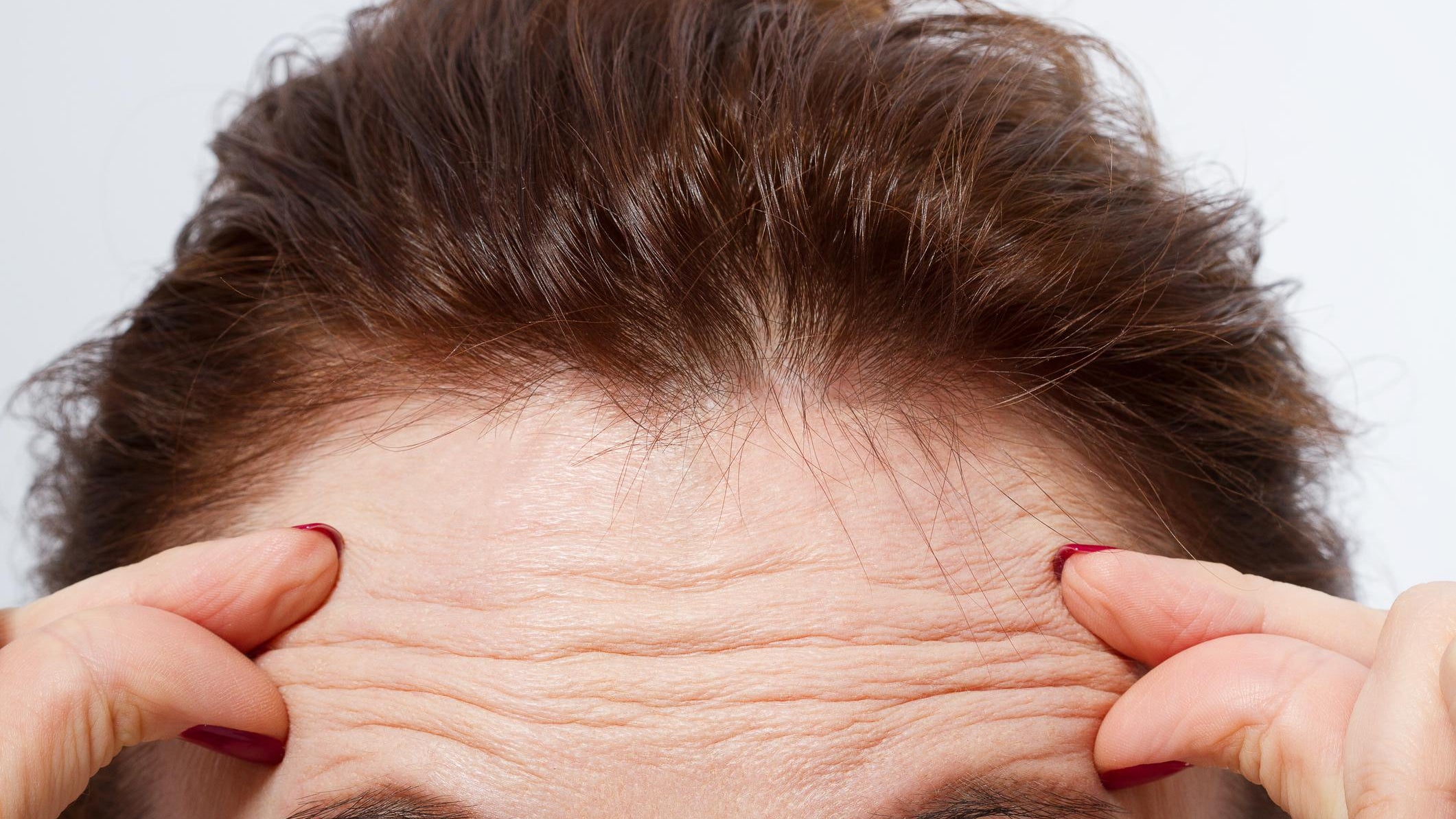 ¿Por qué se forman las arrugas?