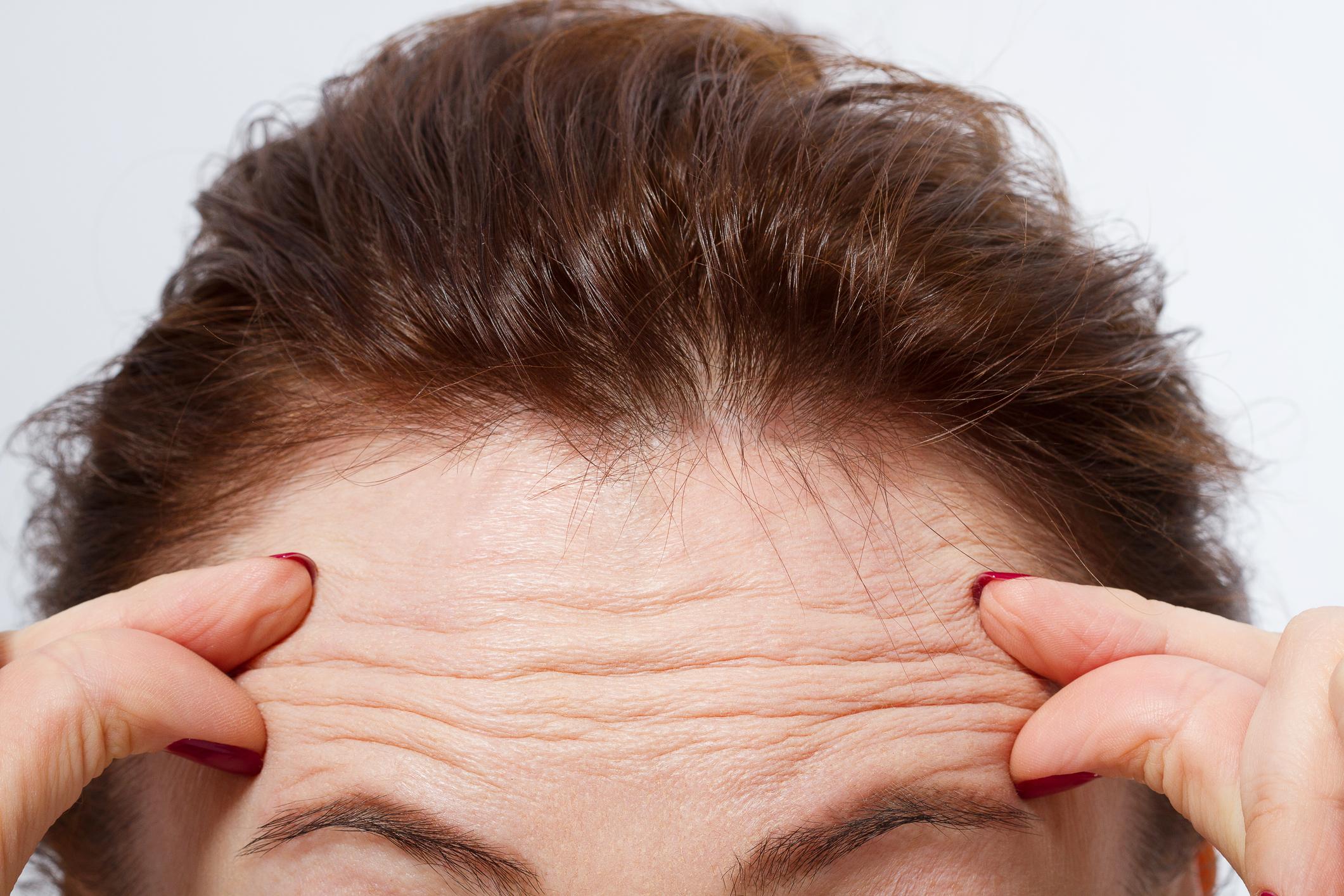 ¿Por qué se forman las arrugas?
