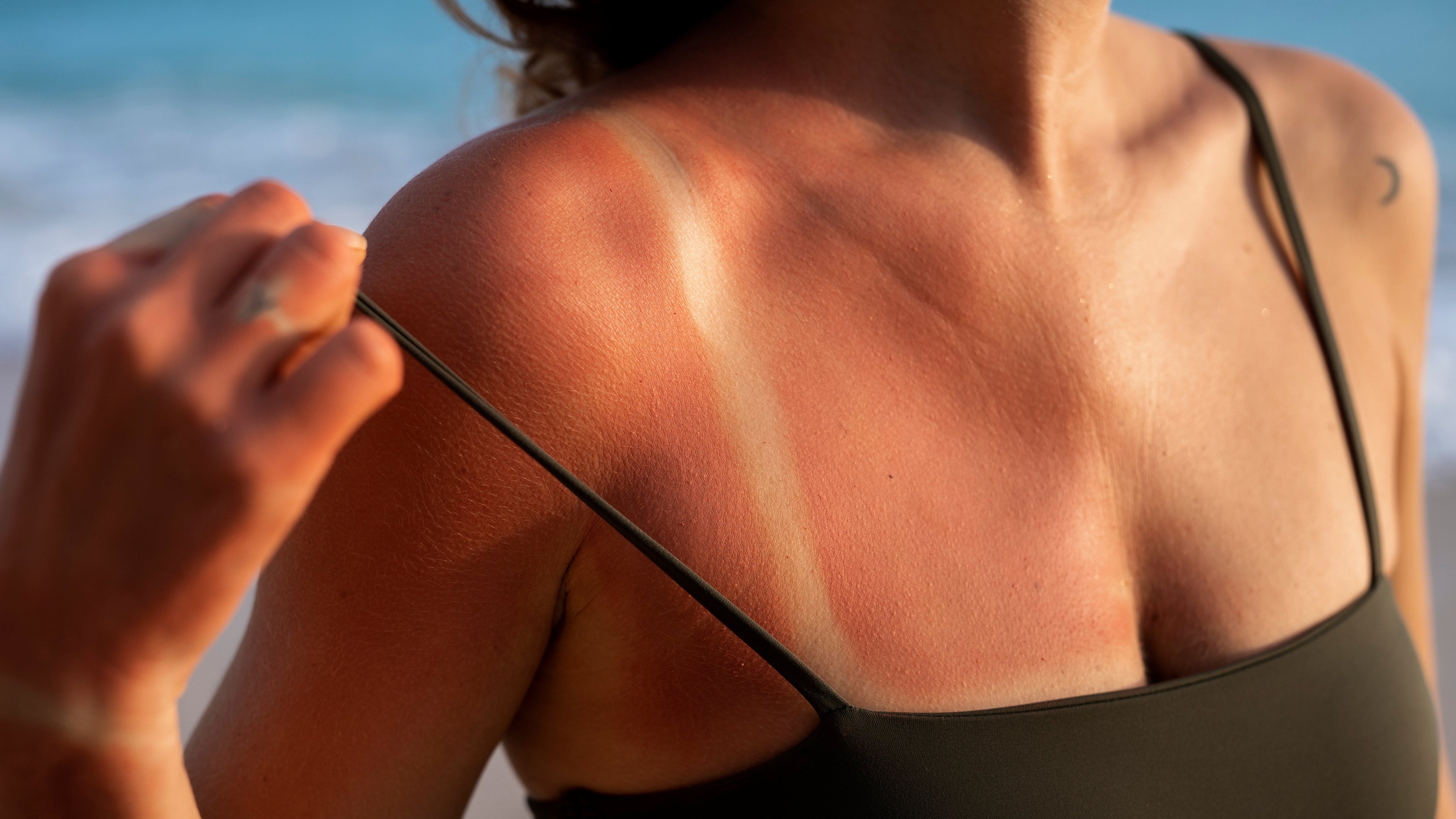 ¡Cuídate del Sol! Radiación solar extrema