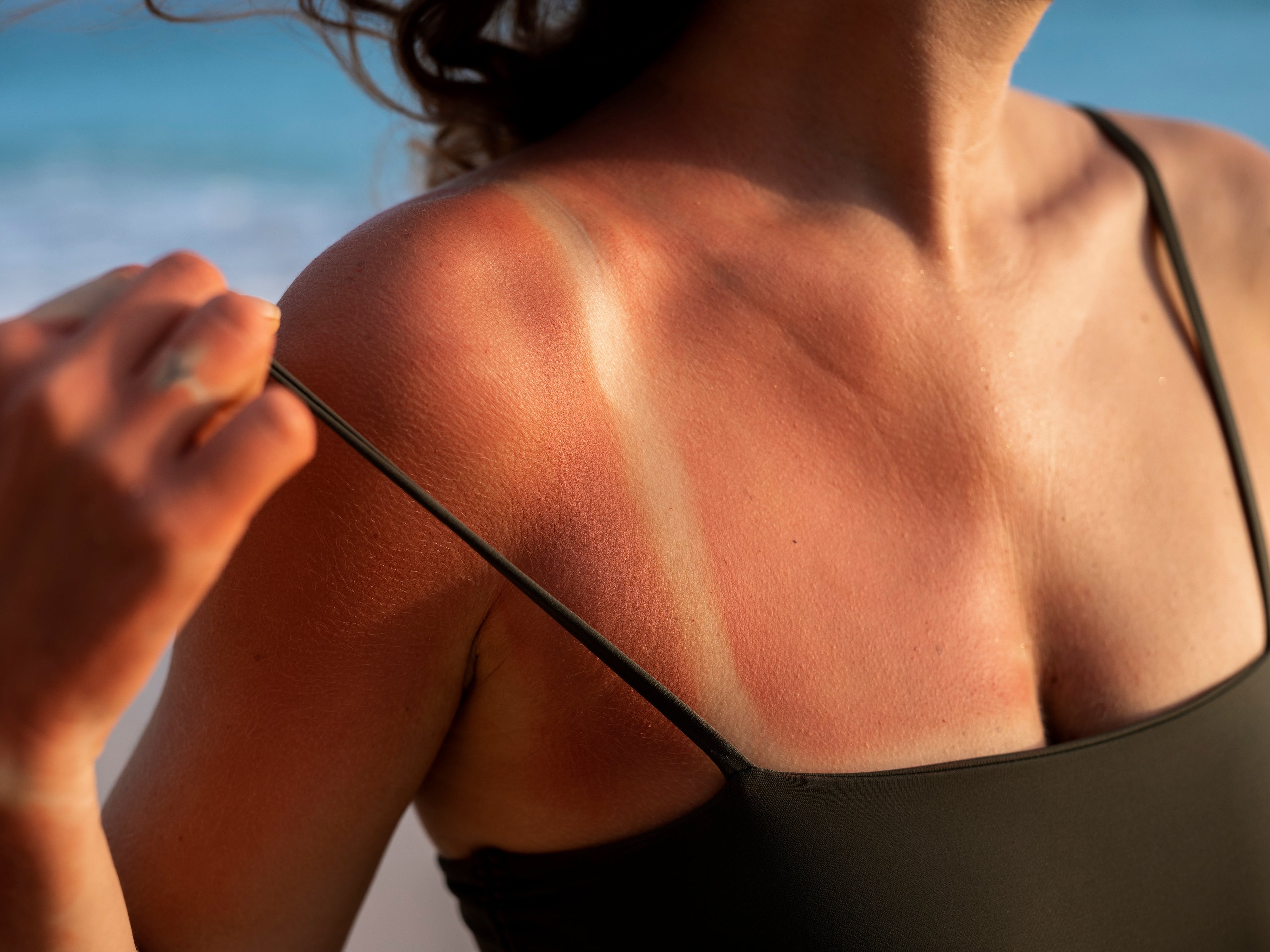 ¡Cuídate del Sol! Radiación solar extrema