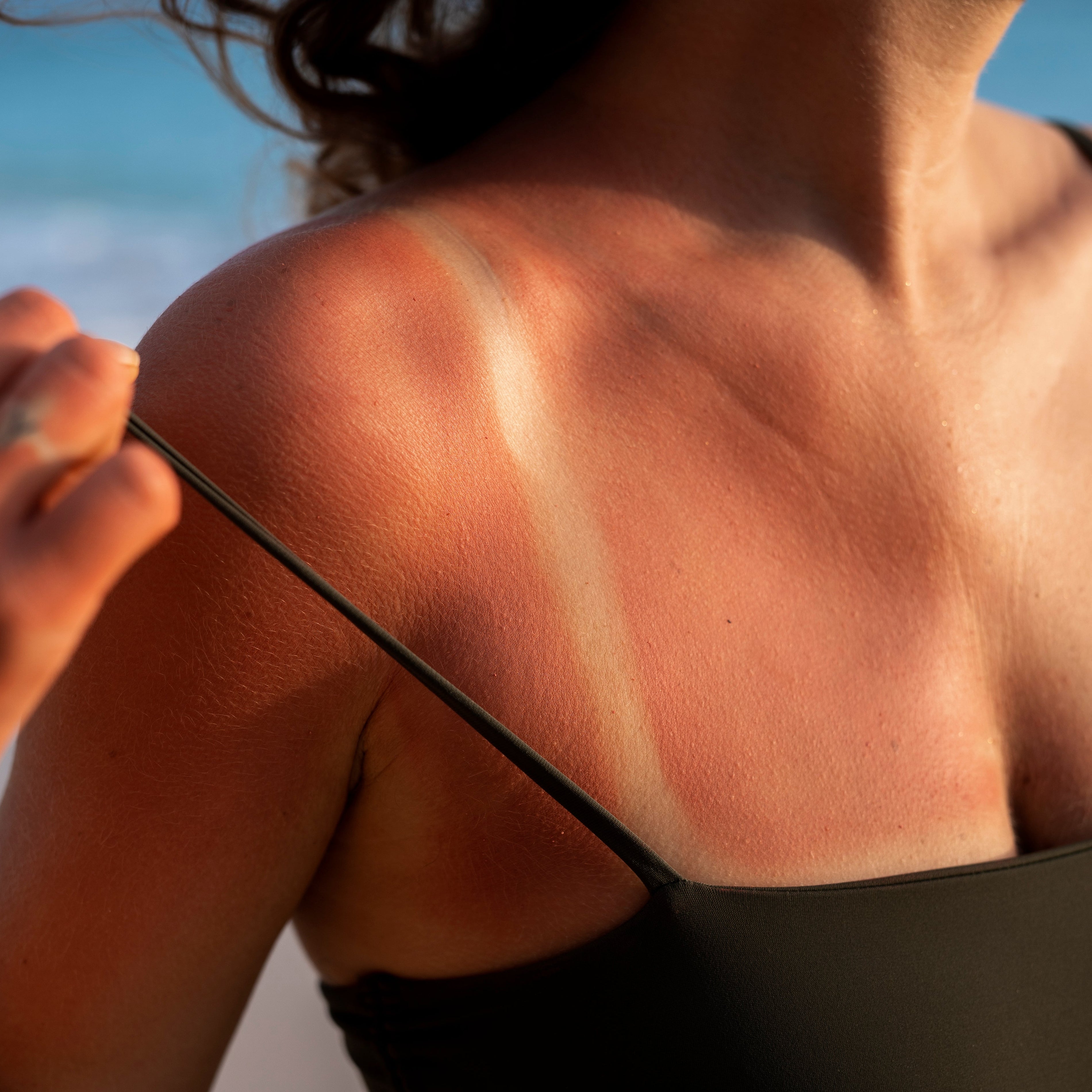 ¡Cuídate del Sol! Radiación solar extrema